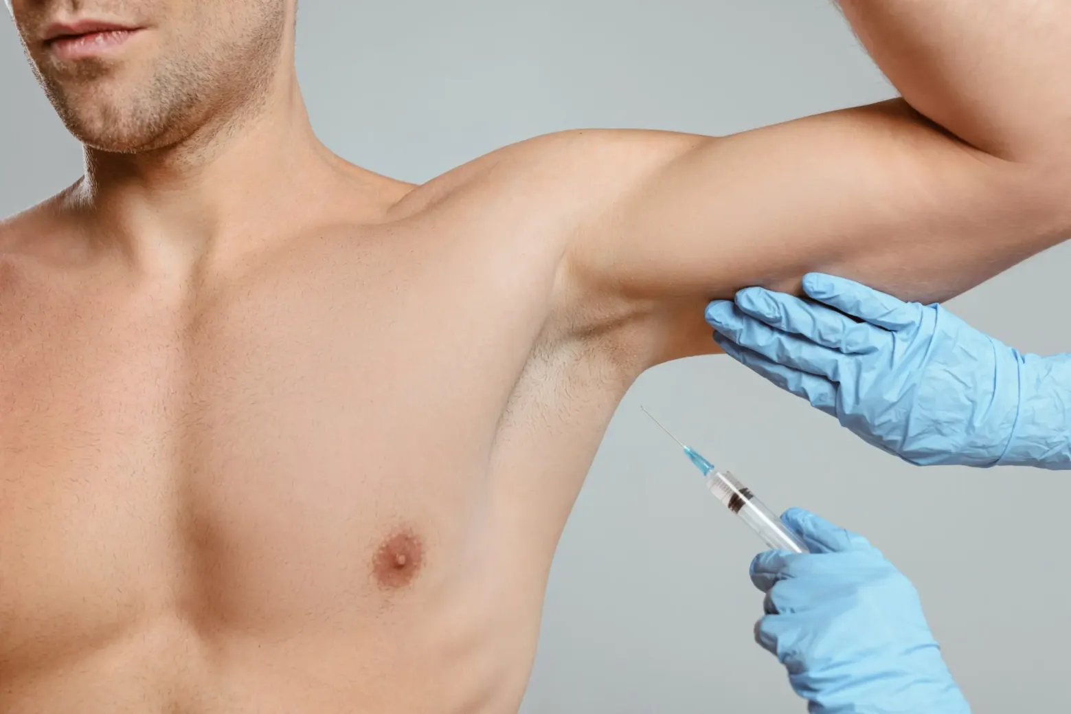 MiraDry underarm sweat reduction treatment image