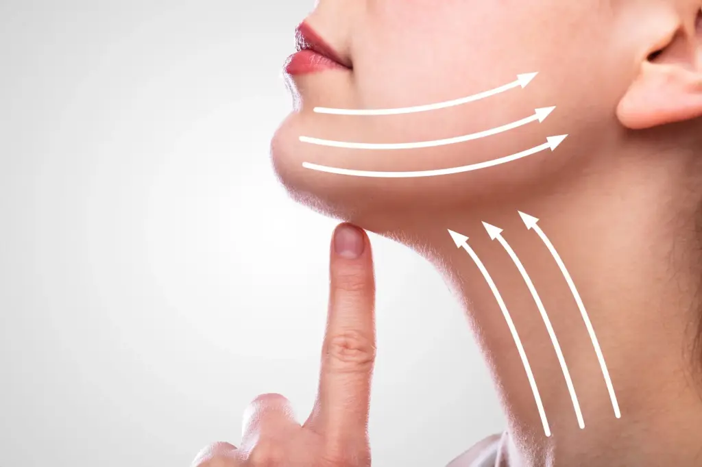 Neck tightening treatment results for sagging skin
