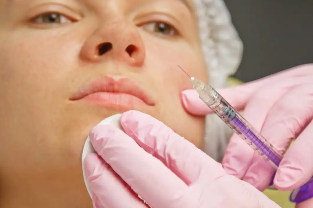 Woman after Dysport injection skincare advice