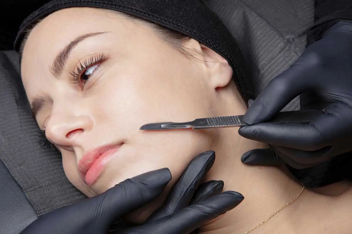 Dermaplaning exfoliation for smooth glowing skin