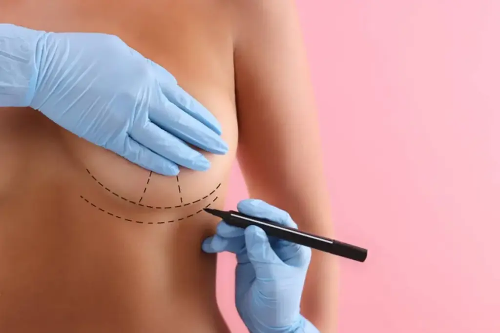Liposuction body contouring session requirements