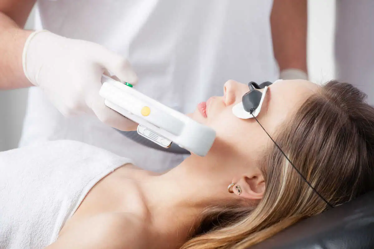 Morpheus8 RF microneedling for skin tightening