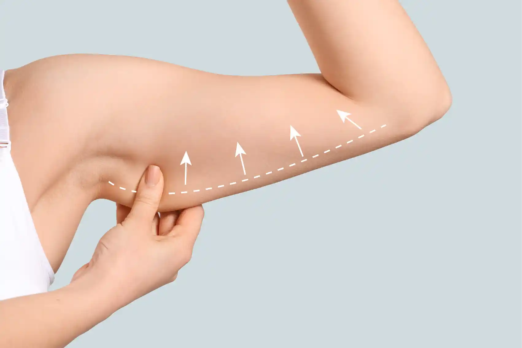 Arm lift surgery aesthetic improvement