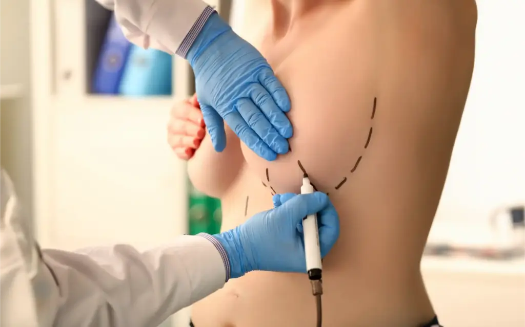 Breast reduction surgery in Bismarck ND