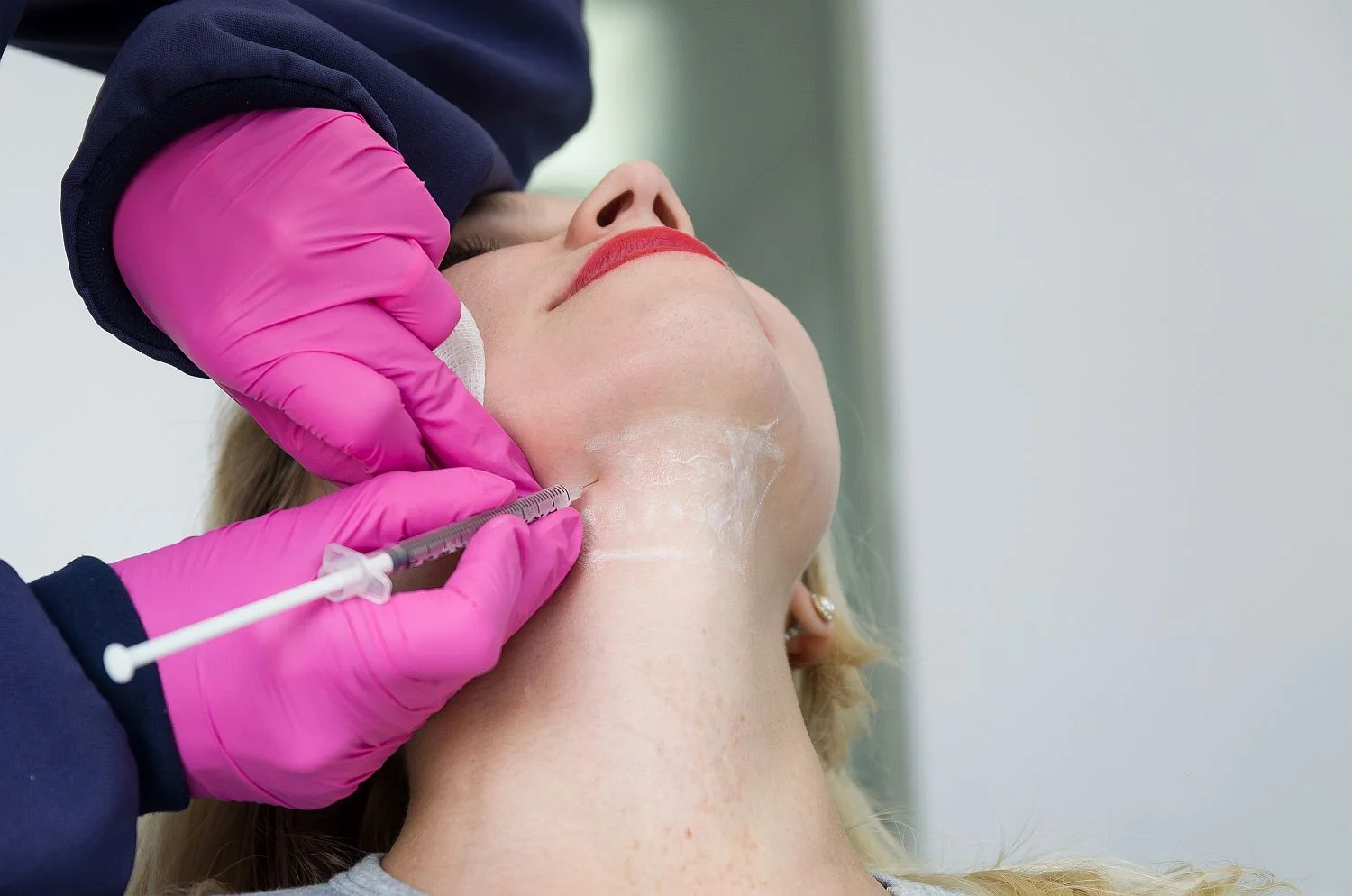 Kybella treatments for double chin in North Dakota