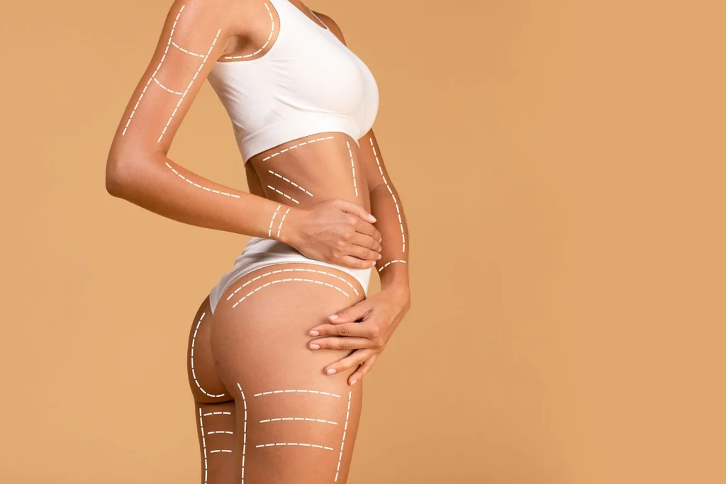 CoolTone muscle toning treatment in North Dakota