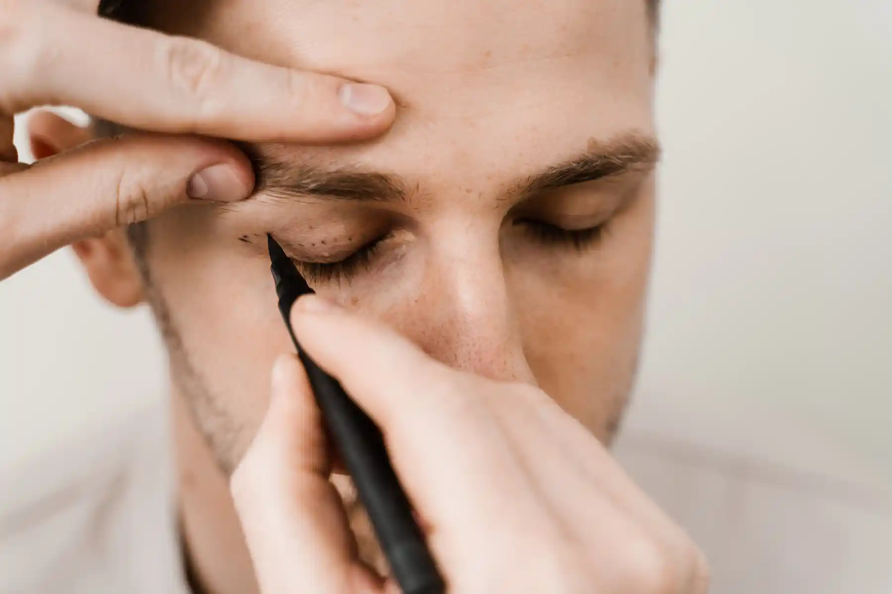 Blepharoplasty results in Bismarck ND