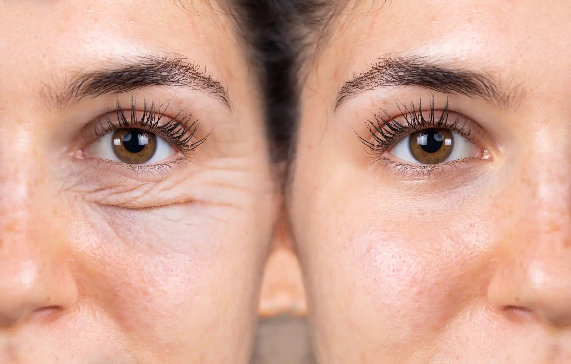 Eyelid surgery services in Bismarck ND