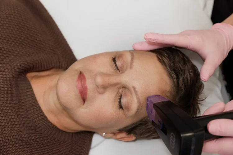 Morpheus8 treatment procedure at The Aesthetic Center North Dakota