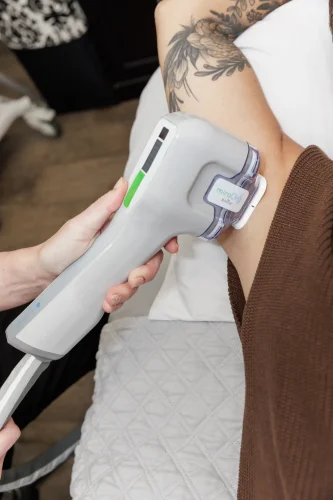 miraDry sweat reduction treatment at The Aesthetic Center, North Dakota